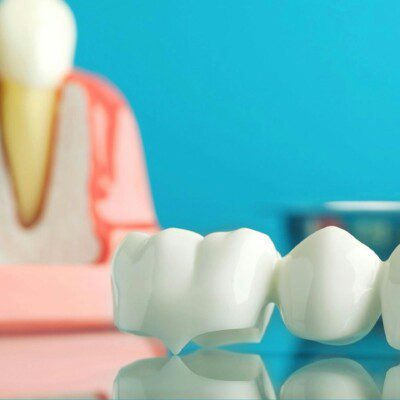 passion dental 118