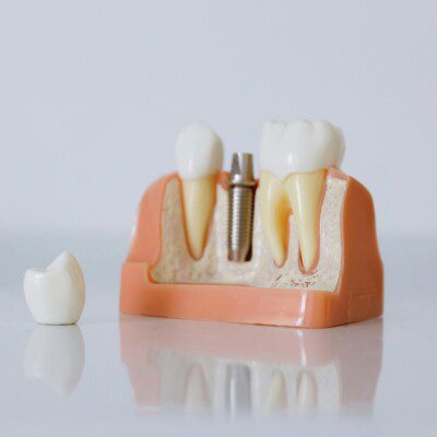 passion dental 124