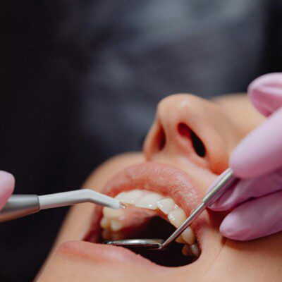 passion dental 133 scaled