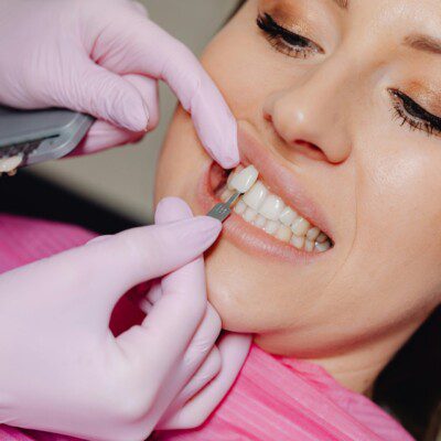 passion dental 135