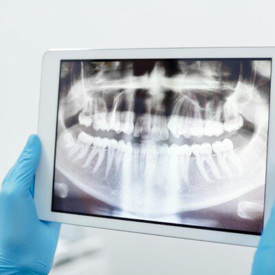 passion dental 157