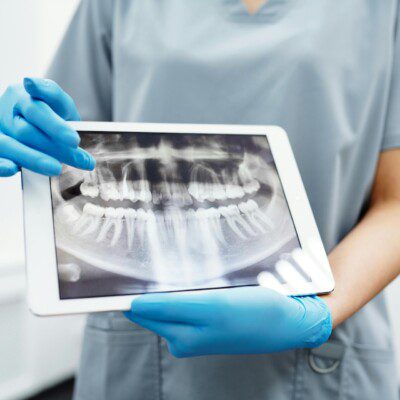 passion dental 181